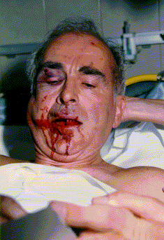 Robert Faurisson after Jewish assault